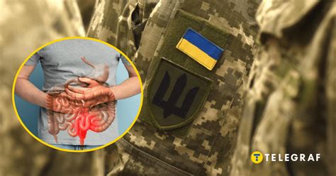 псориаз в военное время украина|С какими болезнями кожи не мобилизуют в Украине